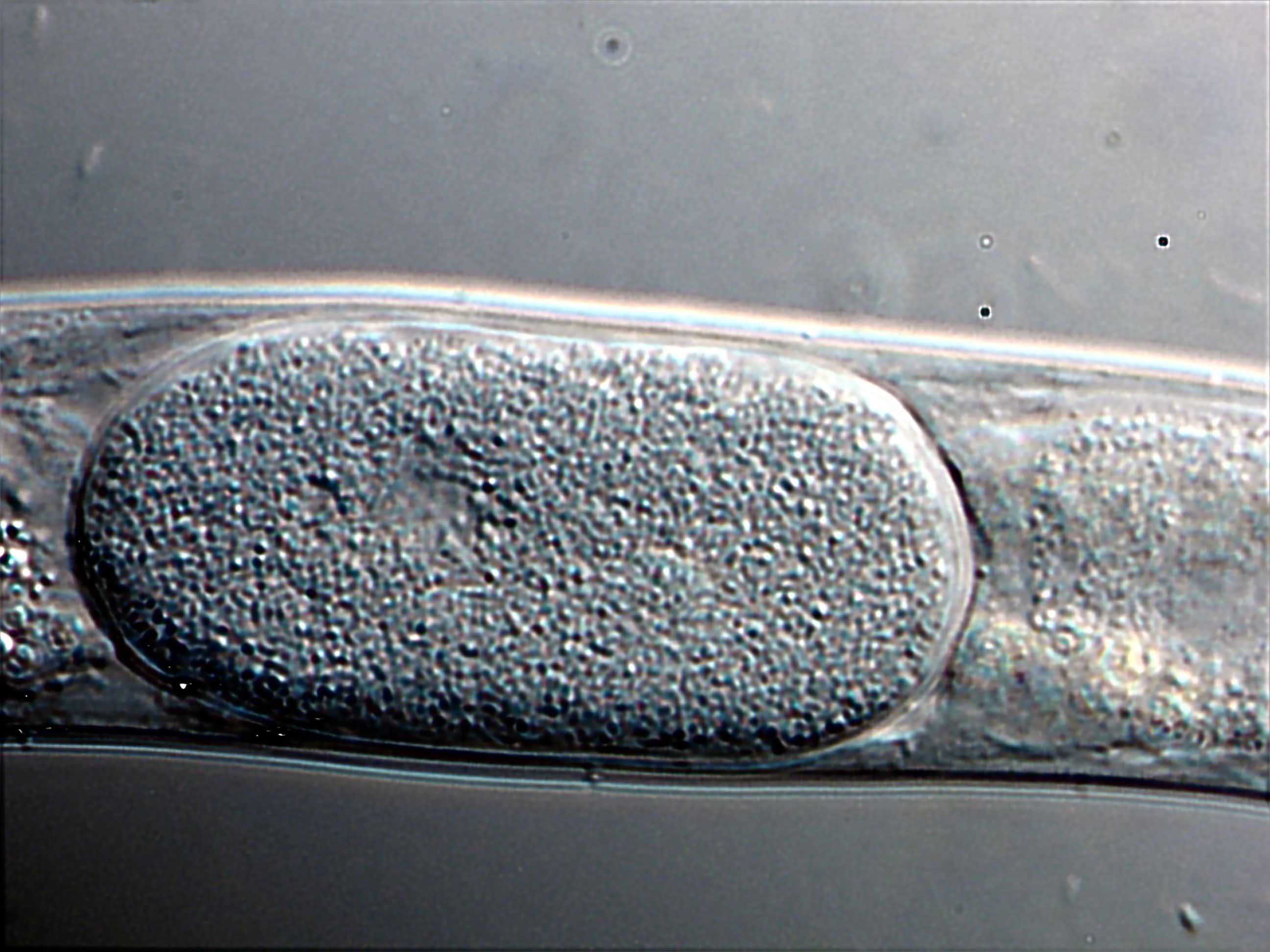 Uovo di Nematode